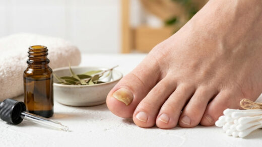 7 Ayurvedic Home Remedies for Toenail Fungus: What May Help?