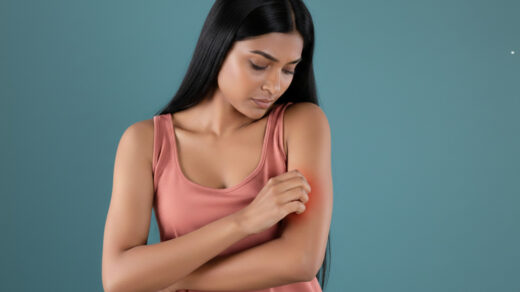 Ayurvedic Treatment for Hand Eczema | Natural Remedies